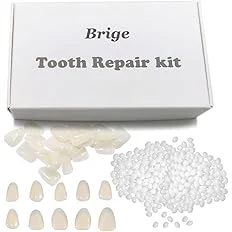 composite veneers
