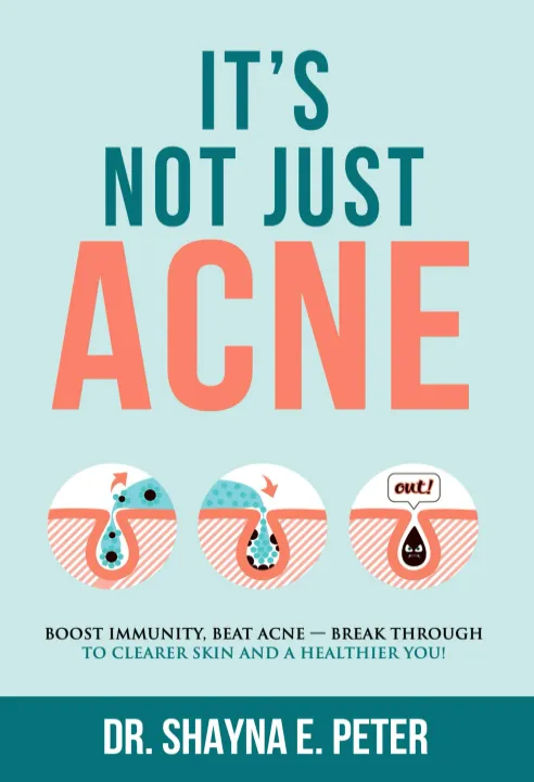 Foods to avoid for hormonal acne 3 Foods to avoid for hormonal acne