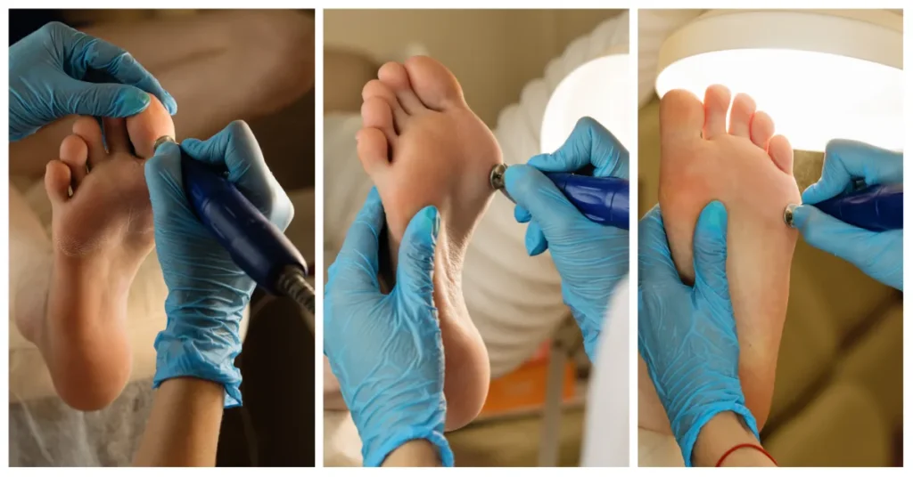 Hair Sliver foot: Triple Health Connection